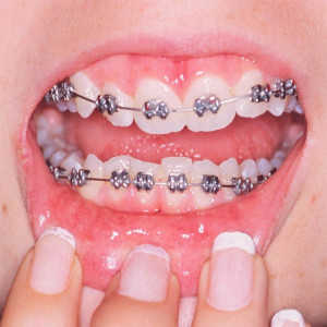 收聽Horse Head的Teeth (Explicit)歌詞歌曲