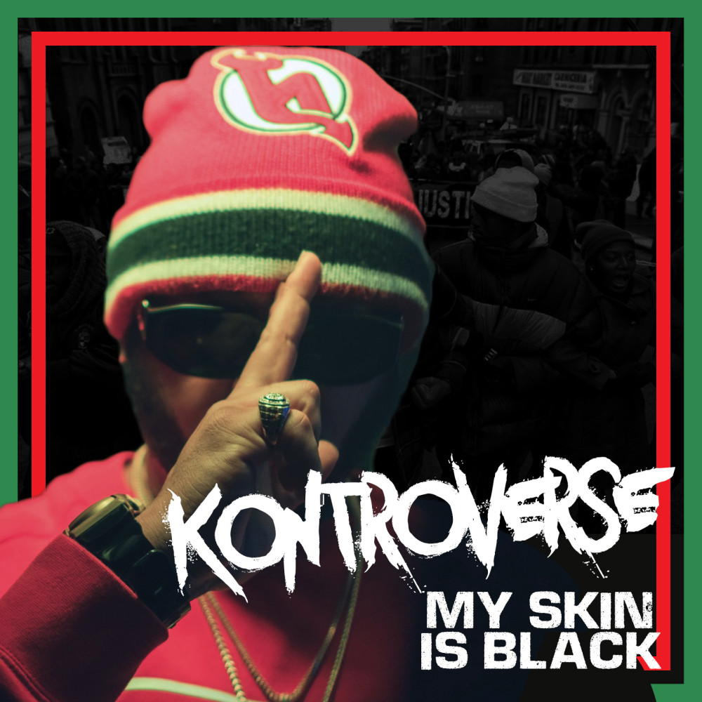 My Skin Is Black (Explicit)