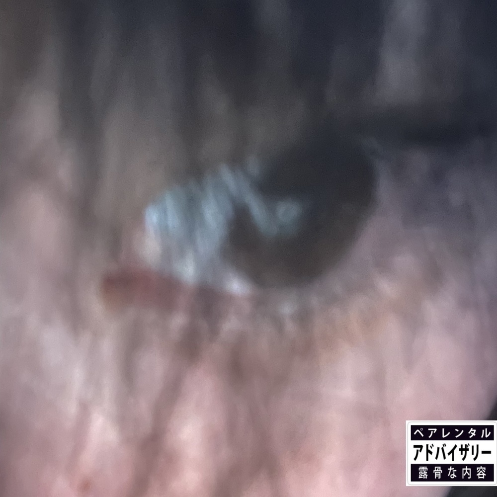 ALAS (cyberpsychosis version) (Explicit)