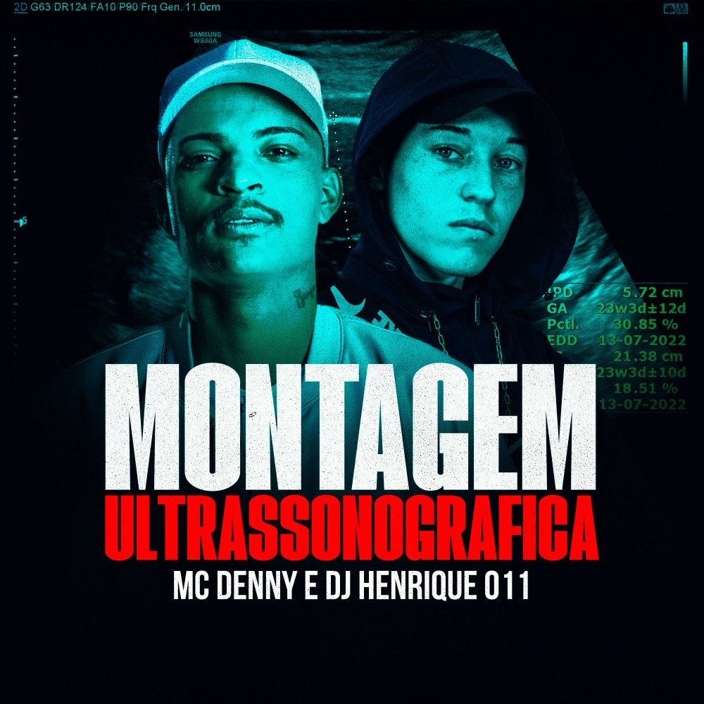 Montagem Ultrassonográfica (Explicit)