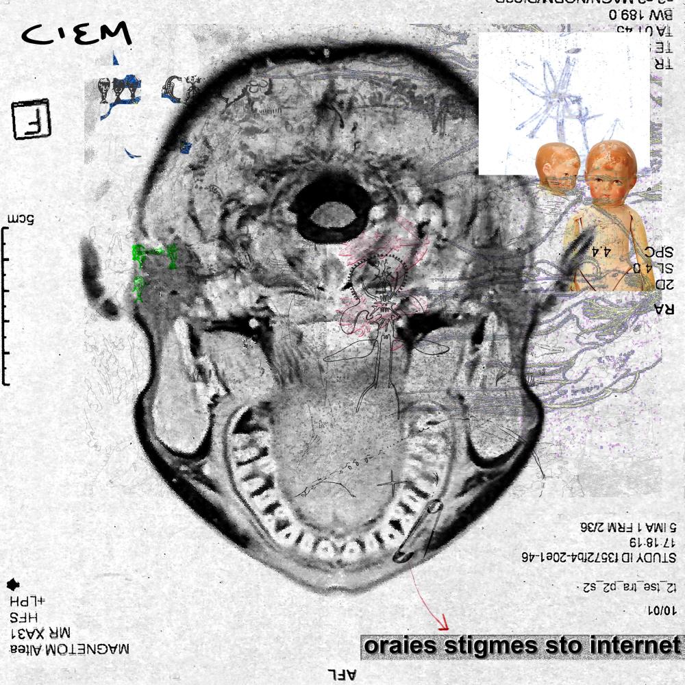 B-Side 1
