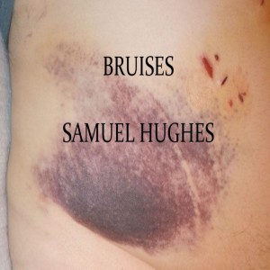 收聽Samuel Hughes的Bruises歌詞歌曲