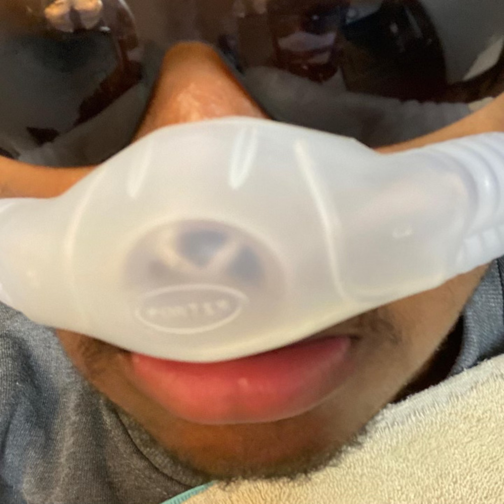 Wisdom Tooth Freestyle