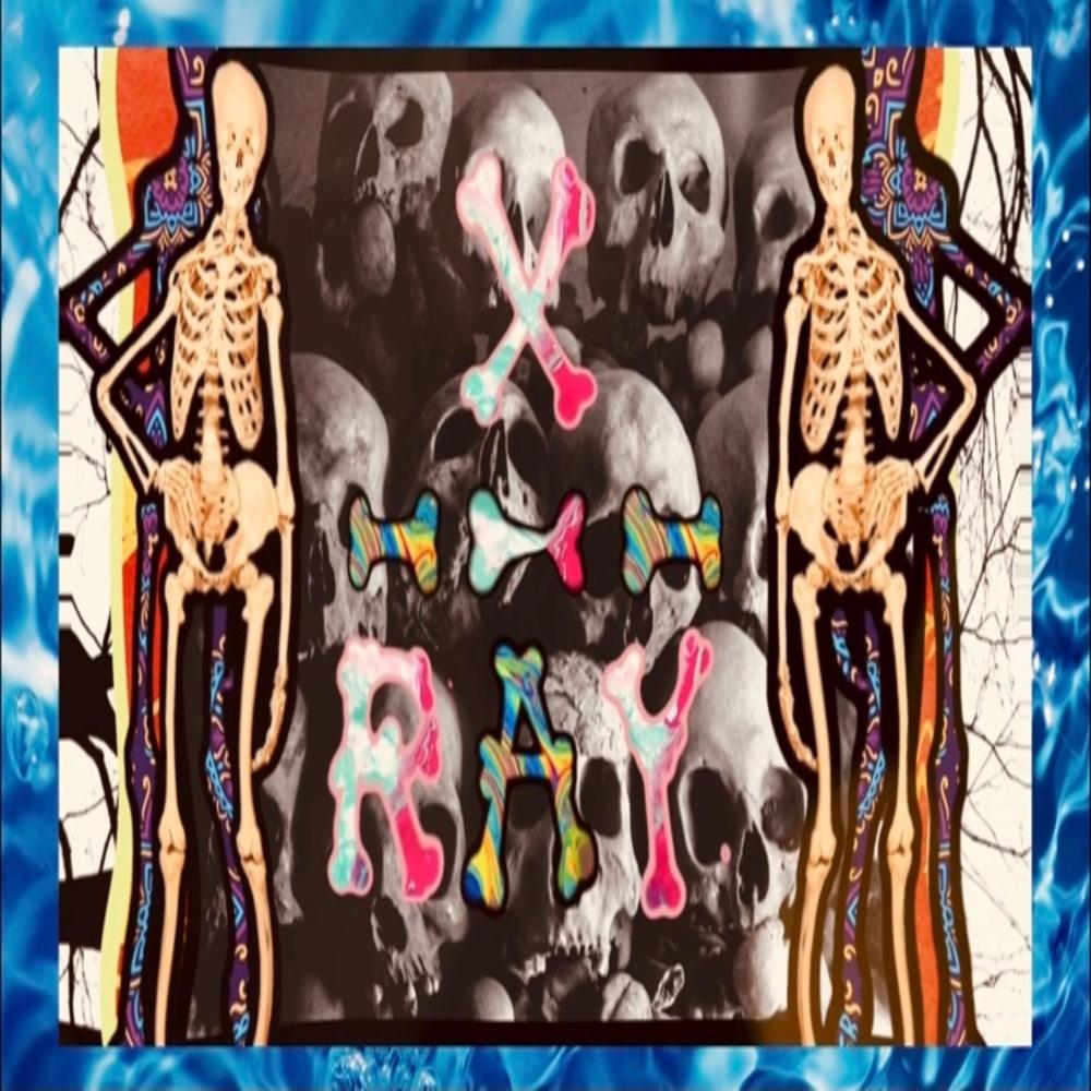 XRAY (Explicit)