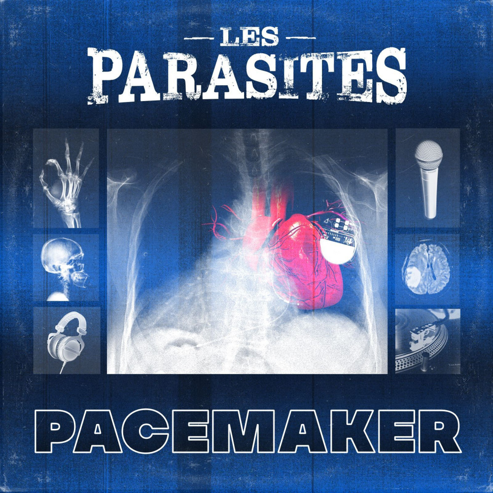Pacemaker