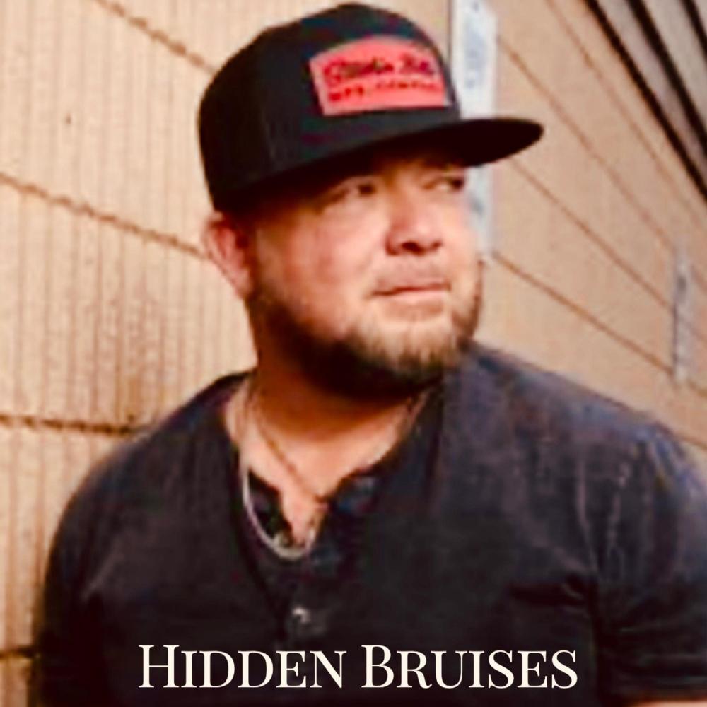 Hidden Bruises