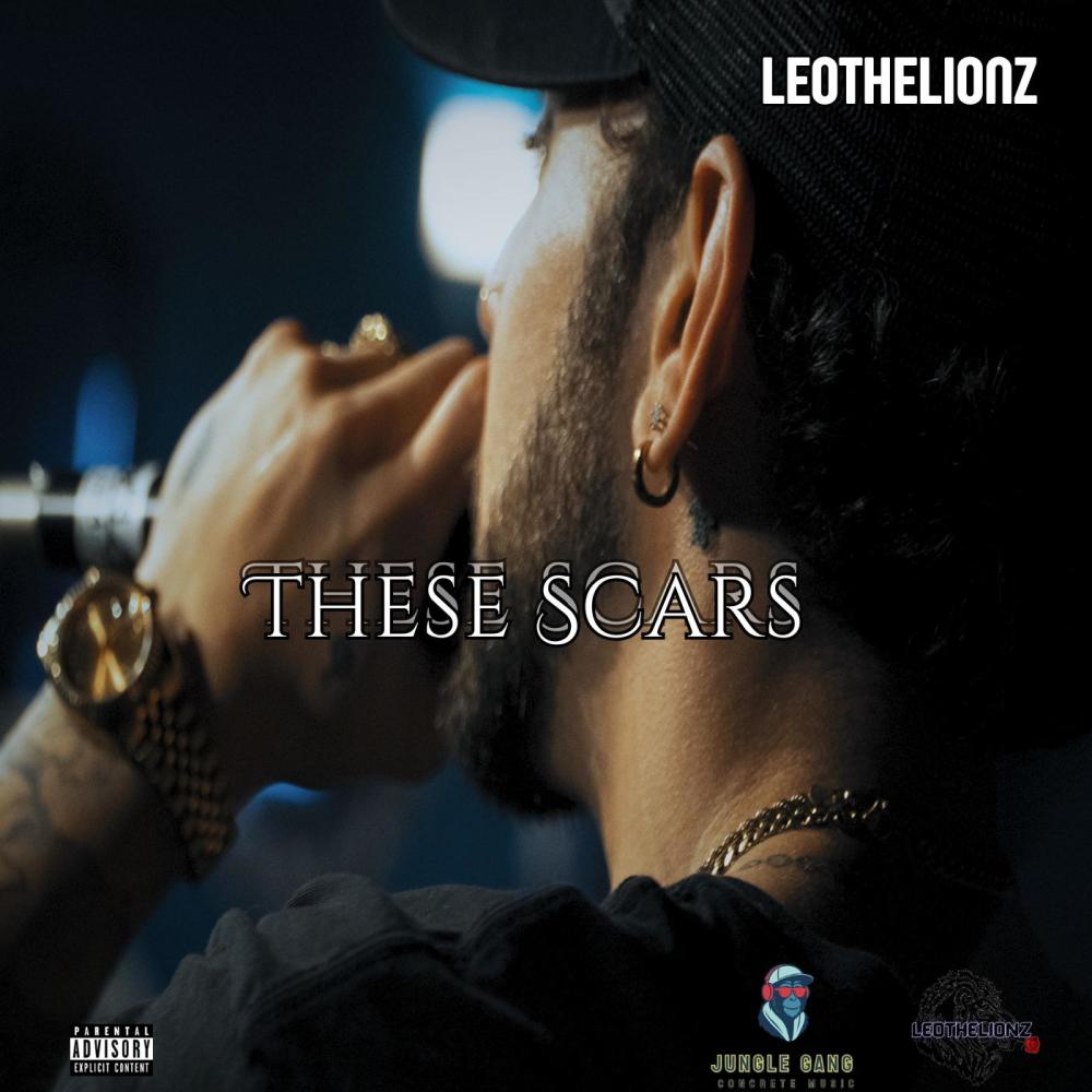 These Scars, Pt. 1 (Explicit)