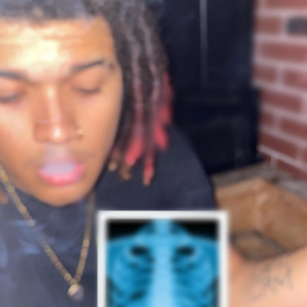 fat albert (Explicit)