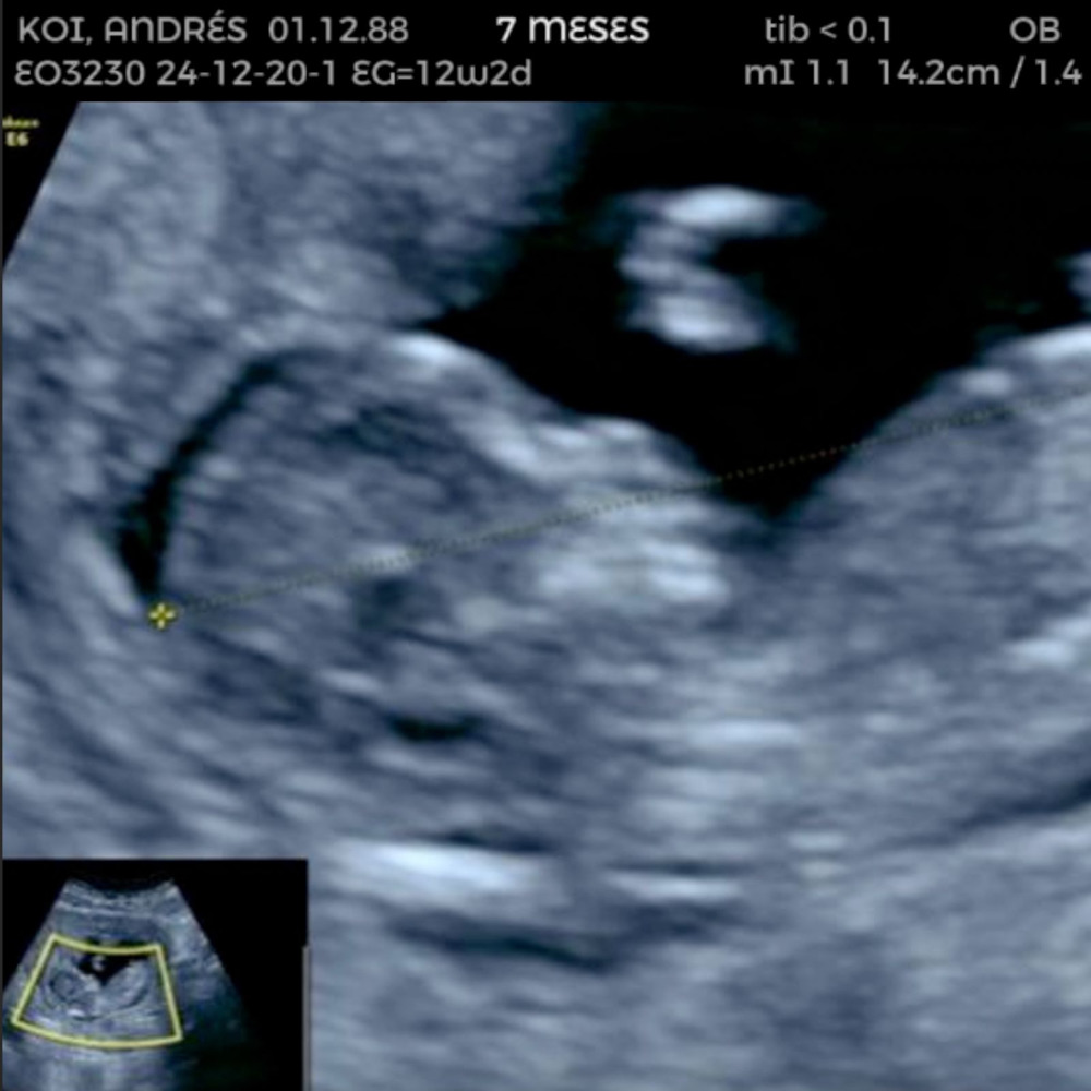 7 Meses