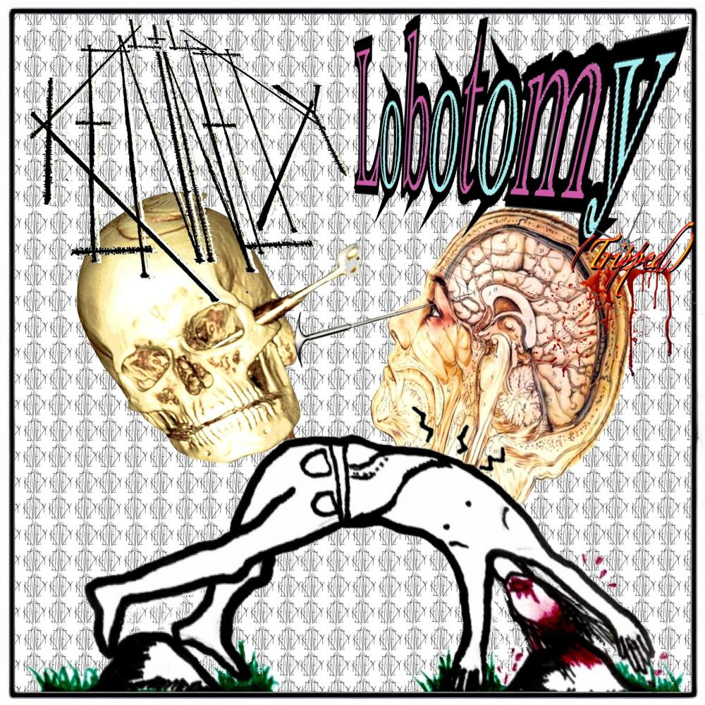 Lobotomy (Tripped) (Explicit)
